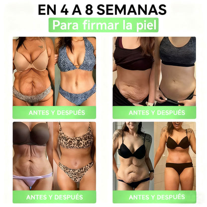 La solución oral para el peso y la salud Solaryra® GLP-1 + SGLT-2i favorece la pérdida de peso, mantiene la salud cardiovascular, mejora la diabetes, aborda la apnea del sueño, promueve la salud intestinal, reafirma la piel y proporciona energía.-TJY