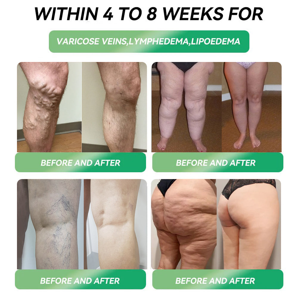 FDA | Tienda oficial de EE. UU. — Solución oral Solaryra® Telportide, solución de doble acción para bajar de peso con GIP y GLP-1, un frasco al día, resultados en 7 días🛍️-ABB8