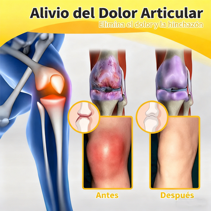 Alivio para huesos y articulaciones con veneno de abeja — 🔥70 % de descuento por tiempo limitado🔥