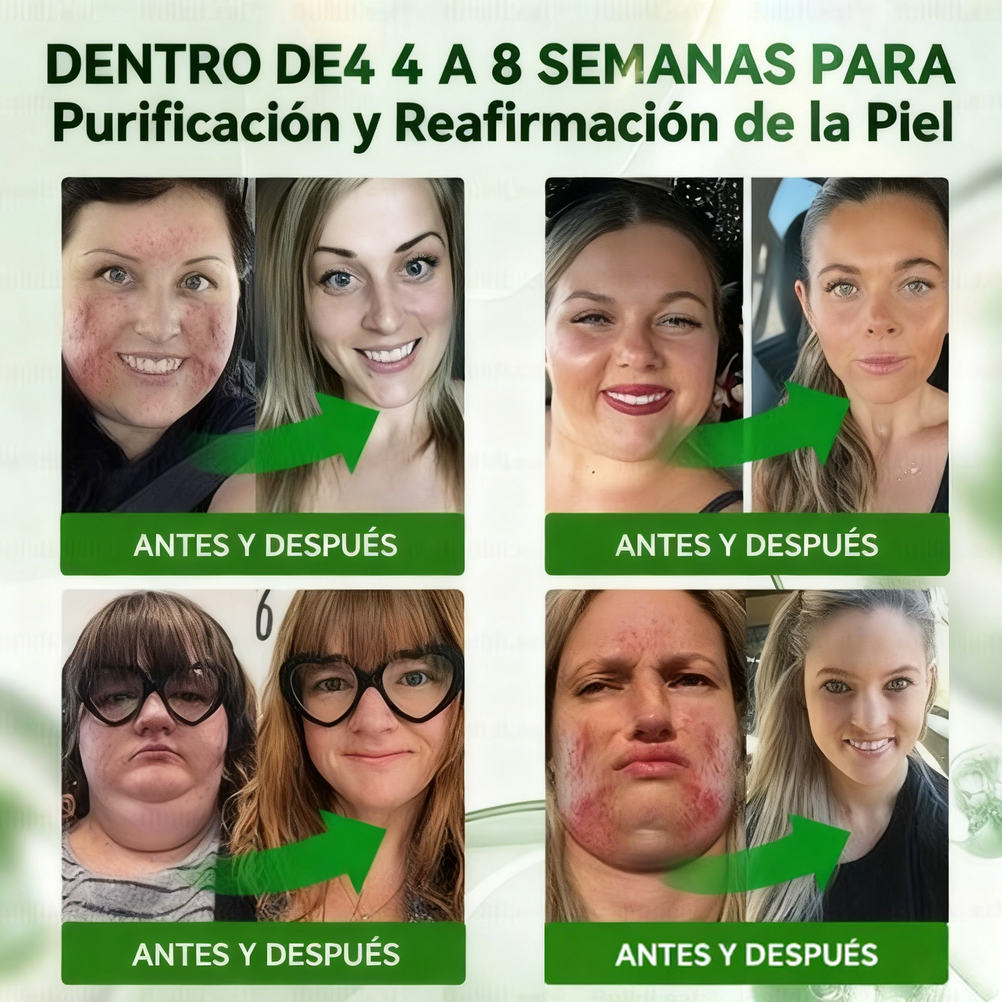 Solaryra® 𝑮𝑳𝑷-1 𝑮𝒖𝒕 𝑪𝒍𝒆𝒂𝒏𝒔𝒆 𝒂𝒏𝒅 𝑺𝒍𝒊𝒎 𝑺𝒖𝒑𝒑𝒐𝒓𝒕 𝑭𝒐𝒓𝒎𝒖𝒍𝒂 (𝐎𝐧𝐜𝐞 𝐚 𝐝𝐚𝐲, 𝐫𝐞𝐬𝐮𝐥𝐭𝐬 𝐢𝐧 𝟕 𝐝𝐚𝐲𝐬) 𝑾𝒊𝒕𝒉 10 𝑩𝒊𝒍𝒍𝒊𝒐𝒏 𝑪𝑭𝑼 𝑨𝒄𝒕𝒊𝒗𝒆 𝑷𝒓𝒐𝒃𝒊𝒐𝒕𝒊𝒄𝒔, 𝑺𝒖𝒑𝒑𝒐𝒓𝒕𝒔 𝒘𝒆𝒊𝒈𝒉𝒕 𝒎𝒂𝒏𝒂𝒈𝒆𝒎𝒆𝒏𝒕, 𝒉𝒆𝒂𝒓𝒕 𝒉𝒆𝒂𝒍𝒕𝒉, 𝒅𝒊𝒂𝒃𝒆𝒕𝒆𝒔, 𝒈𝒖𝒕 & 𝒘𝒐𝒎𝒆𝒏'𝒔 𝒉𝒆𝒂𝒍𝒕𝒉, 𝒇𝒊𝒓𝒎𝒊𝒏𝒈 𝒔𝒌𝒊𝒏,𝒘𝒉𝒊𝒍𝒆 𝒔𝒆𝒂𝒔𝒐𝒏𝒂𝒍 𝒊𝒎𝒎𝒖𝒏𝒆 𝒔𝒖𝒑𝒑𝒐𝒓𝒕-TJY