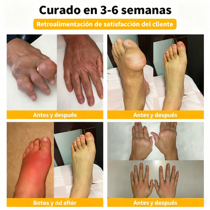 Alivio para huesos y articulaciones con veneno de abeja — 🔥70 % de descuento por tiempo limitado🔥