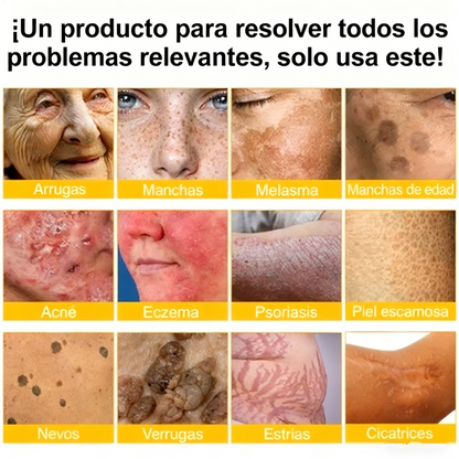 Crema restauradora de la piel con veneno de abeja Cleansing® aprobada por la FDA — 🔥70 % de descuento por tiempo limitado🔥