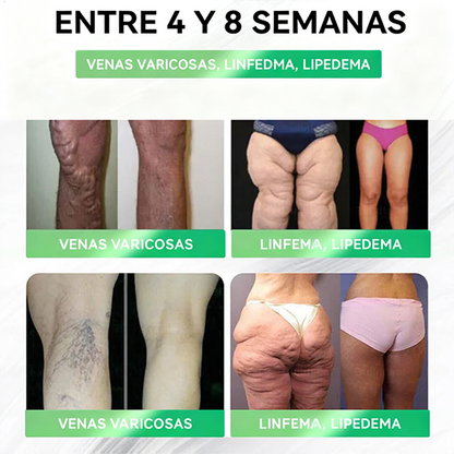 𝑺𝐨𝐥𝐚𝐫𝐲𝐫𝐚®  𝑮𝑳𝑷-𝟏 𝟖 𝒆𝒏 𝟏 𝑭𝒊𝒕 & 𝑽𝒊𝒕𝒂𝒍 (𝒔𝒐𝒍𝒐 𝒖𝒏𝒂 𝒗𝒆𝒛 𝒂𝒍 𝒅𝒊́𝒂, 𝒄𝒂𝒎𝒃𝒊𝒐𝒔 𝒗𝒊𝒔𝒊𝒃𝒍𝒆𝒔 𝒆𝒏 𝟕 𝒅𝒊́𝒂𝒔) √ 𝑷𝒂𝒓𝒂 𝒐𝒃𝒆𝒔𝒊𝒅𝒂𝒅, 𝒔𝒂𝒍𝒖𝒅 𝒄𝒂𝒓𝒅𝒊𝒐𝒗𝒂𝒔𝒄𝒖𝒍𝒂𝒓, 𝒅𝒊𝒂𝒃𝒆𝒕𝒆𝒔, 𝒂𝒑𝒏𝒆𝒂 𝒅𝒆𝒍 𝒔𝒖𝒆𝒏̃𝒐, 𝒔𝒂𝒍𝒖𝒅 𝒊𝒏𝒕𝒆𝒔𝒕𝒊𝒏𝒂𝒍, 𝒑𝒓𝒐𝒃𝒍𝒆𝒎𝒂𝒔 𝒂𝒓𝒕𝒊𝒄𝒖𝒍𝒂𝒓𝒆𝒔 𝒚 𝒎𝒂́𝒔-ZZQ xy