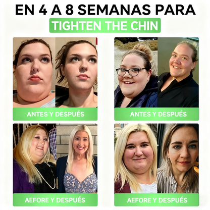 La solución oral para el peso y la salud Solaryra® GLP-1 + SGLT-2i favorece la pérdida de peso, mantiene la salud cardiovascular, mejora la diabetes, aborda la apnea del sueño, promueve la salud intestinal, reafirma la piel y proporciona energía.-TJY