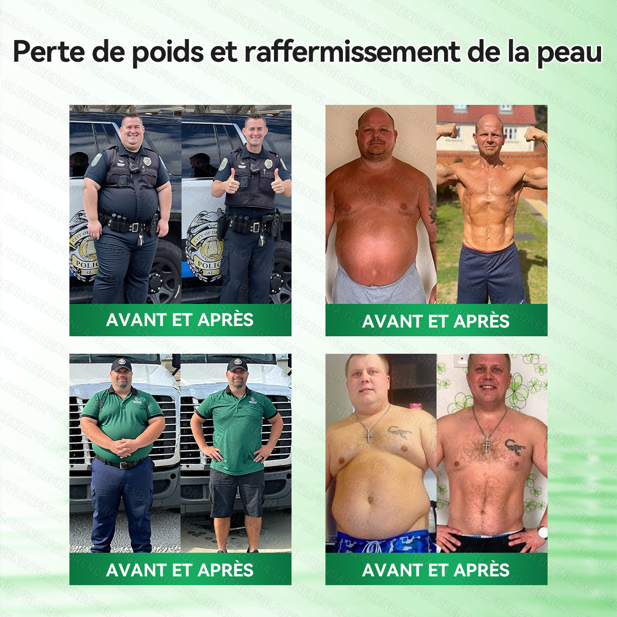 Boutique officielle 📷 Solaryra® Moringa · Berbérine + NAD+ – Patch Microneedle Nano Avancé 10-en-1 (1×/jour, résultats visibles en 7 jours) | Obésité, relâchement cutané, apnée du sommeil, articulations, etc.XA