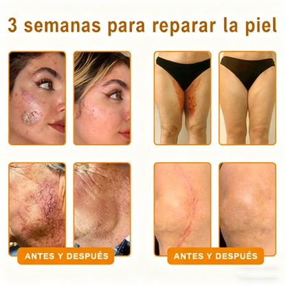 Crema restauradora de la piel con veneno de abeja Cleansing® aprobada por la FDA — 🔥70 % de descuento por tiempo limitado🔥