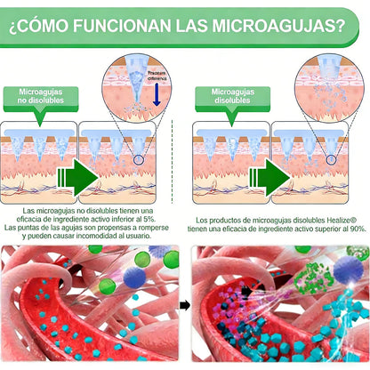 Official Store | Solaryra 12-IN-1 Moringa * Berberine * NAD+Advanced Nano Microneedle Patch (Aceite de palma, Aceite de palmain7days)Para Obesity, Loose Skin, Diabetes, Sleep Apnea, AndJoint Issues🎃-TJY