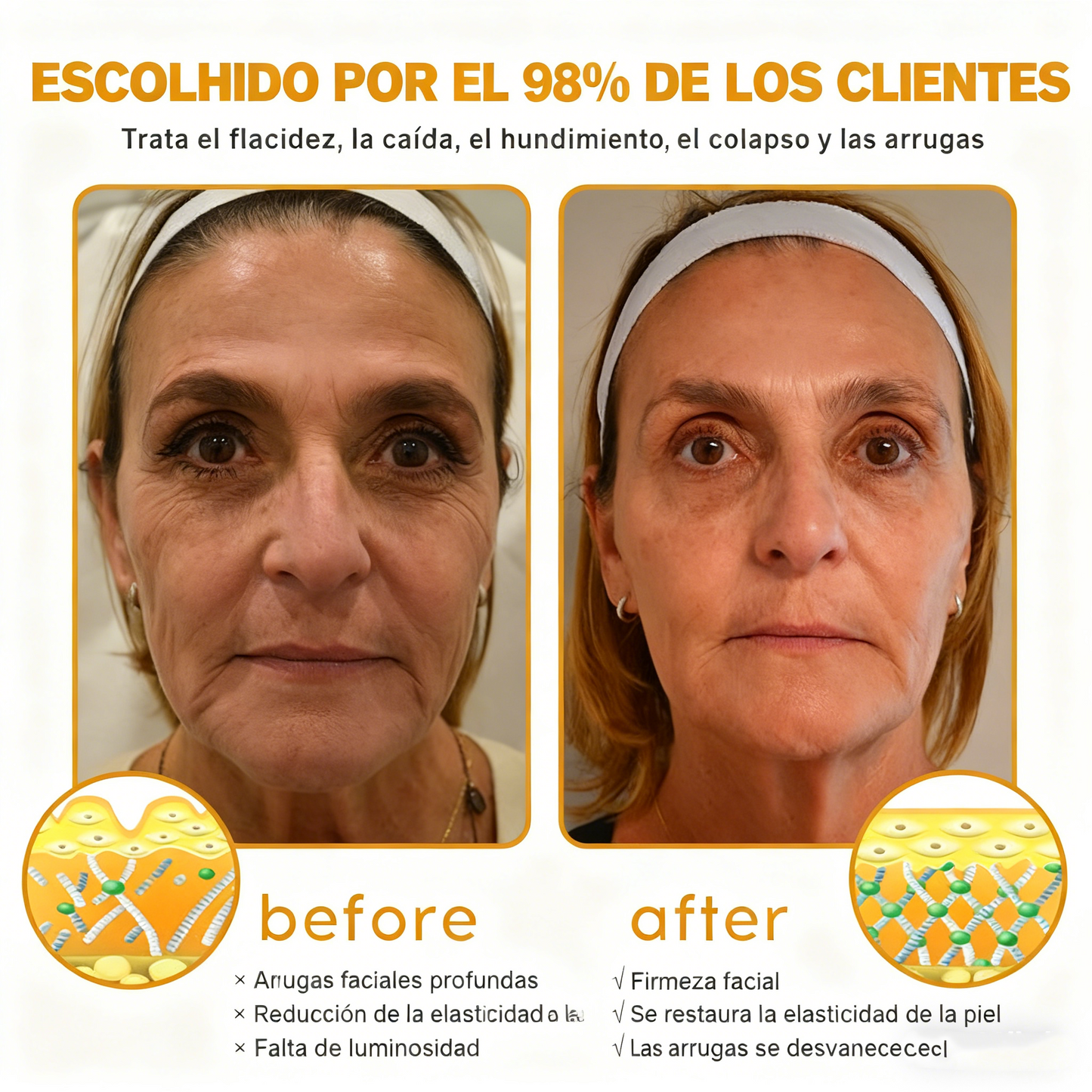 Crema Cleansing® para eliminar arrugas con veneno de abeja y botox (fabricada y enviada desde EE. UU.)