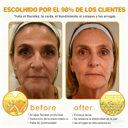 Crema Cleansing® para eliminar arrugas con veneno de abeja y botox (fabricada y enviada desde EE. UU.)