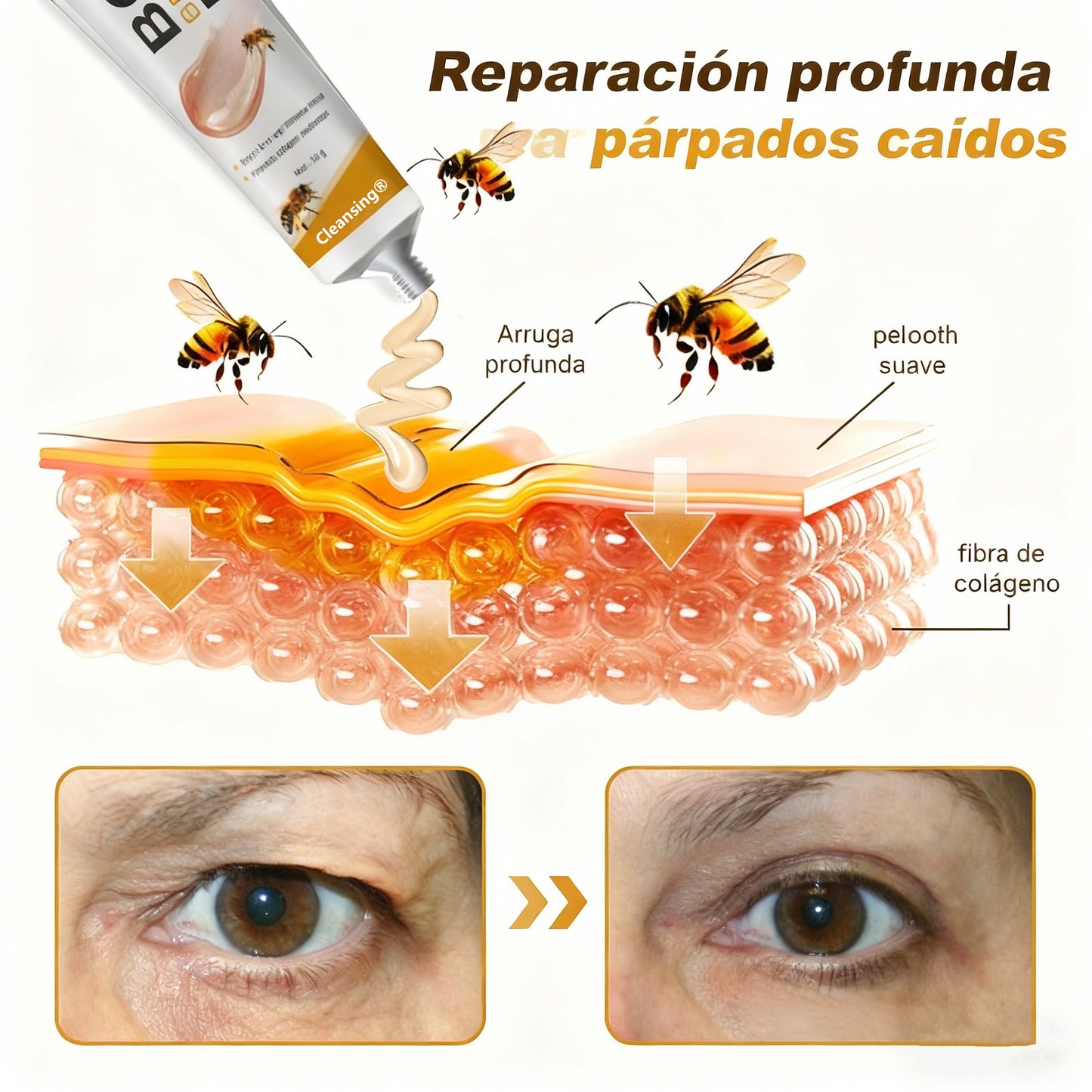 Crema Cleansing® para eliminar arrugas con veneno de abeja y botox (fabricada y enviada desde EE. UU.)