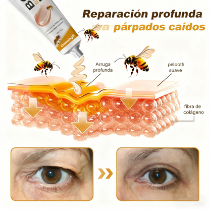 Crema Cleansing® para eliminar arrugas con veneno de abeja y botox (fabricada y enviada desde EE. UU.)