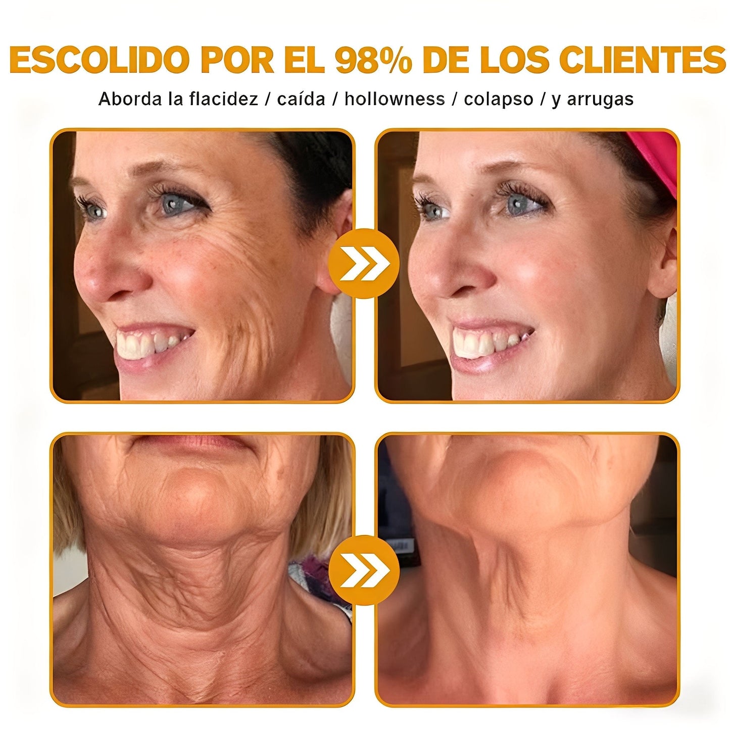 Crema Cleansing® para eliminar arrugas con veneno de abeja y botox (fabricada y enviada desde EE. UU.)
